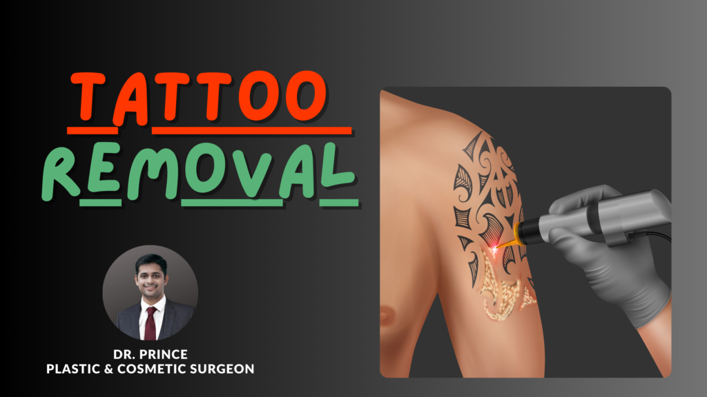 Erasing The Past A Comprehensive Guide To Tattoo Removal By Dr Prince