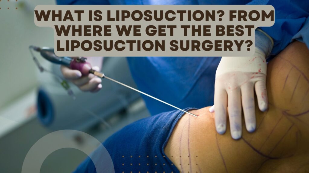 What is Liposuction? From where we get the best Liposuction surgery?