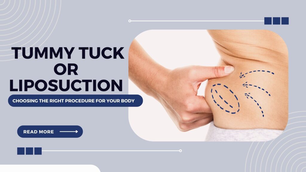 liposuction or tummy tuck