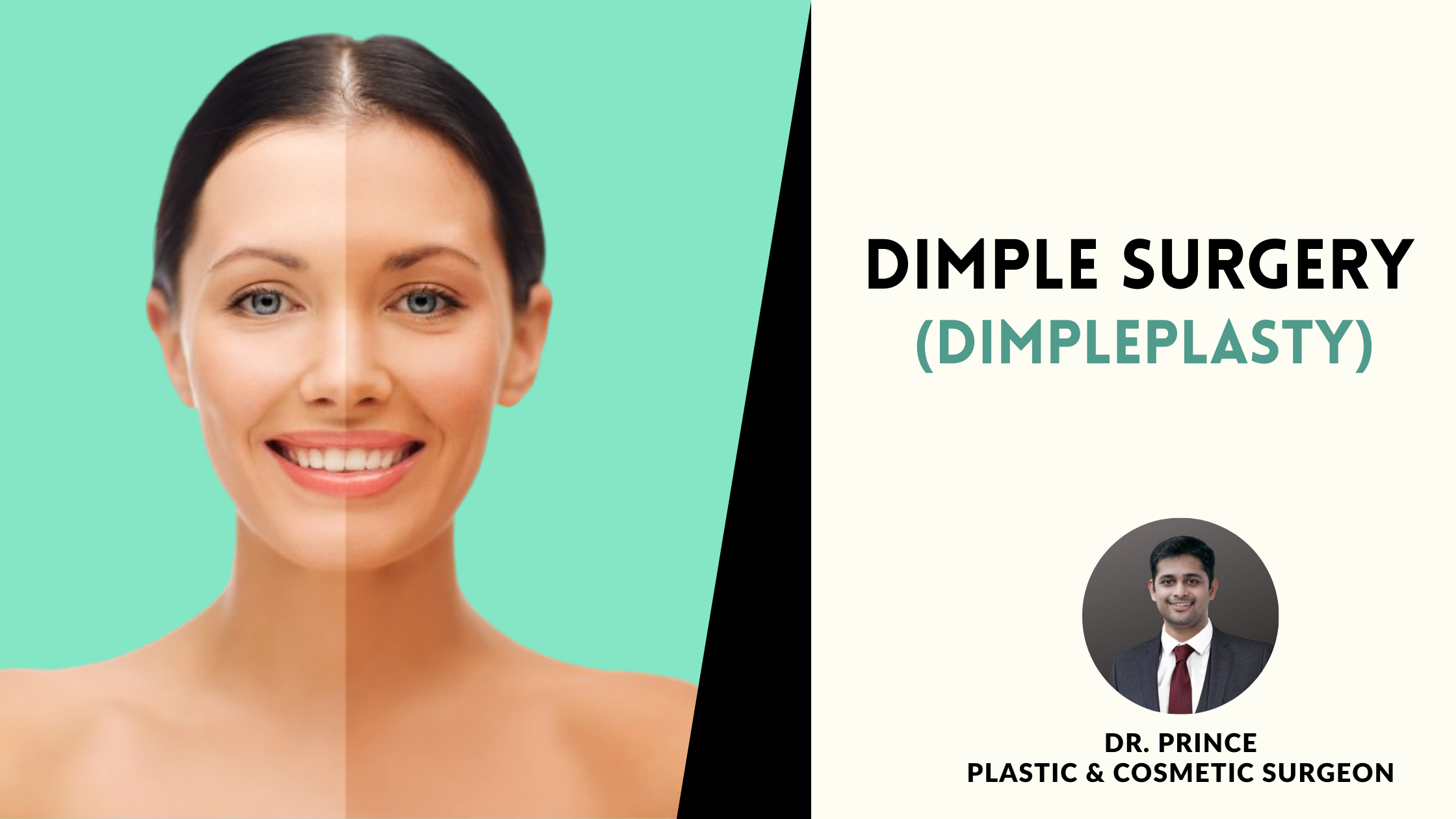 Before-and-after view showcasing the charming results of Dimpleplasty by Dr. Prince in Kerala. Playful and artfully created dimples enhance facial charm, reflecting a natural and harmonious aesthetic transformation.
