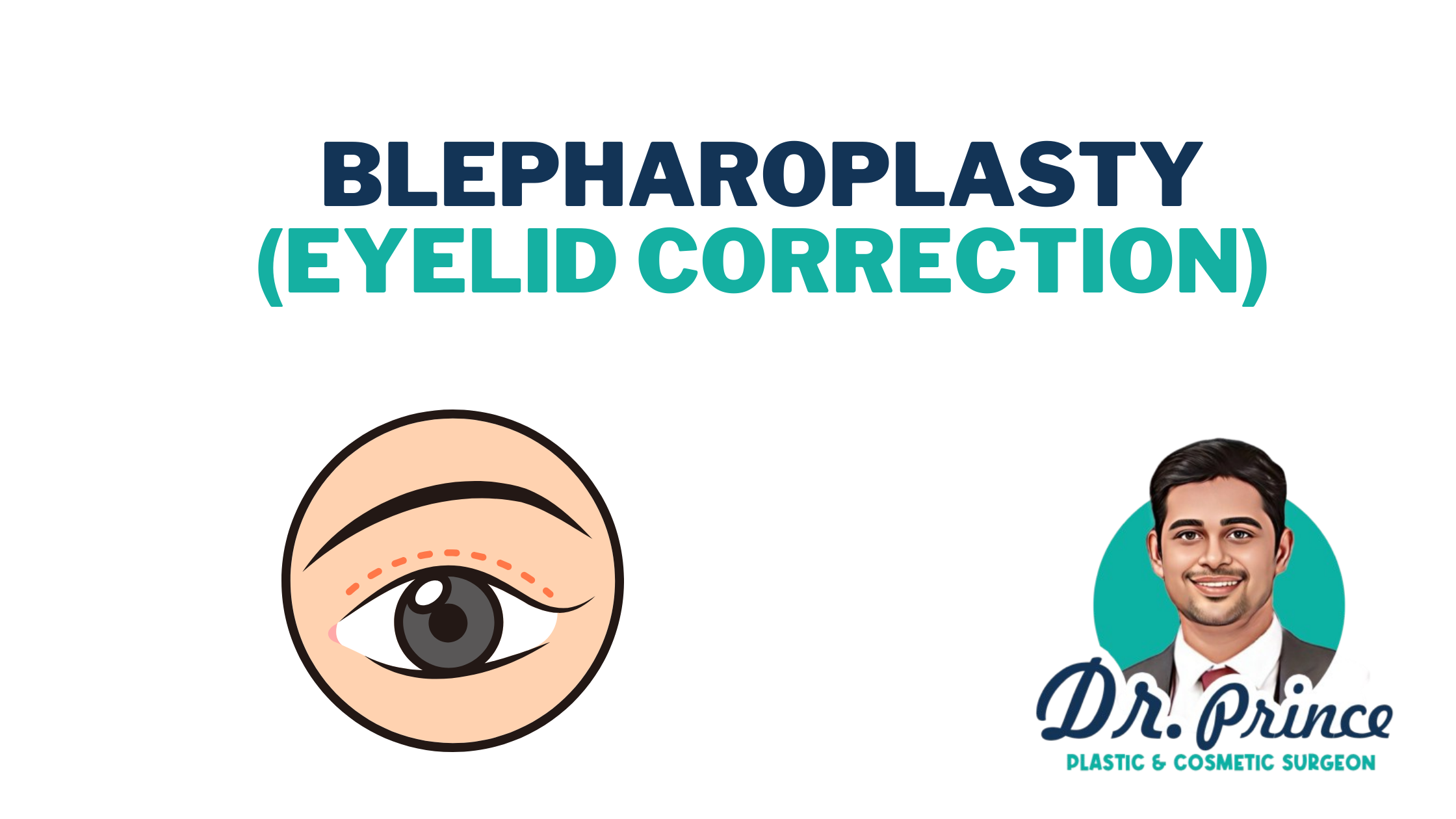 Dr. Prince answering frequently asked questions about Blepharoplasty, the transformative eyelid enhancement procedure.