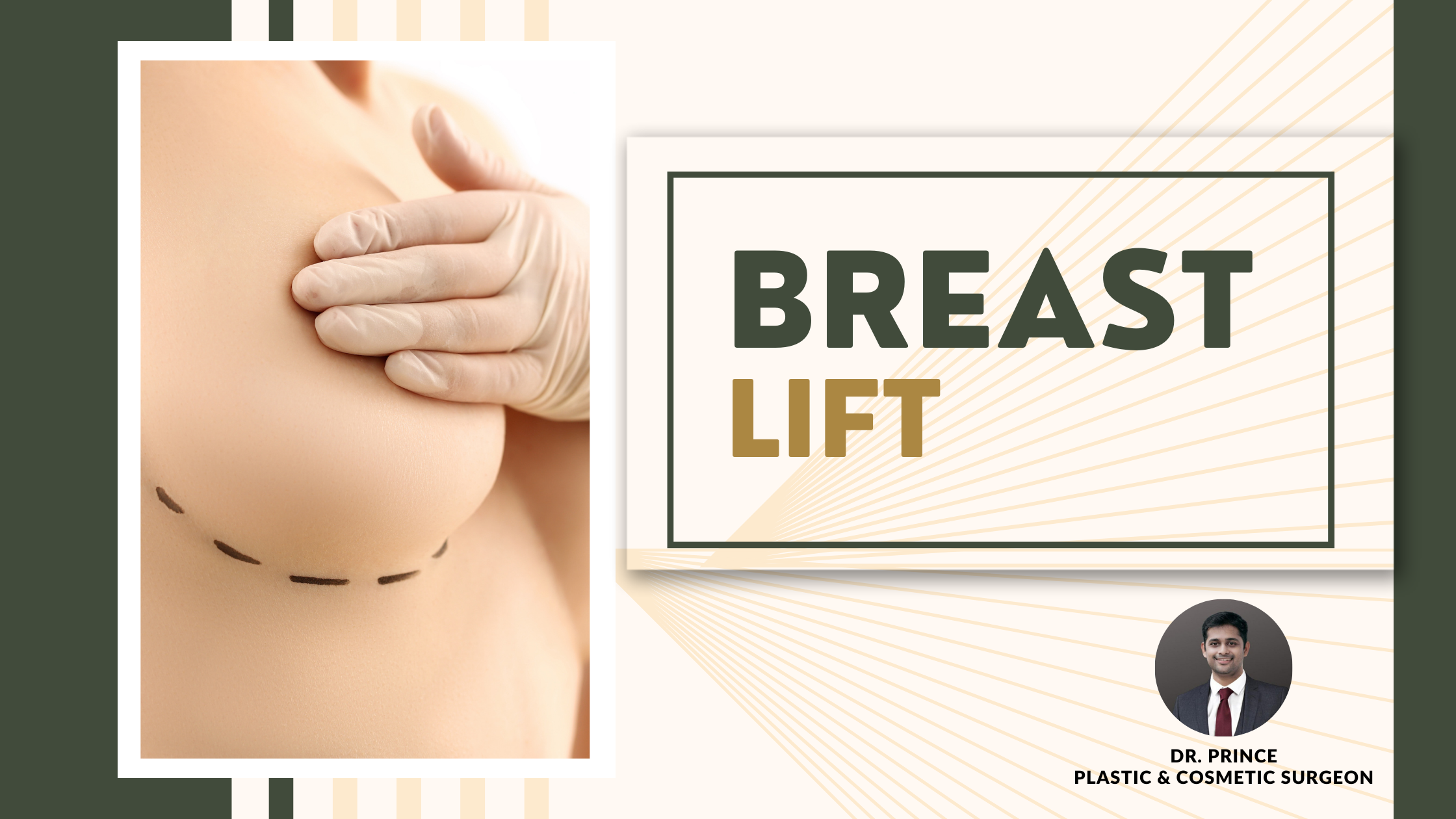 Dr. Prince performs breast lift surgery, artfully sculpting natural and uplifted contours for enhanced breast aesthetics.