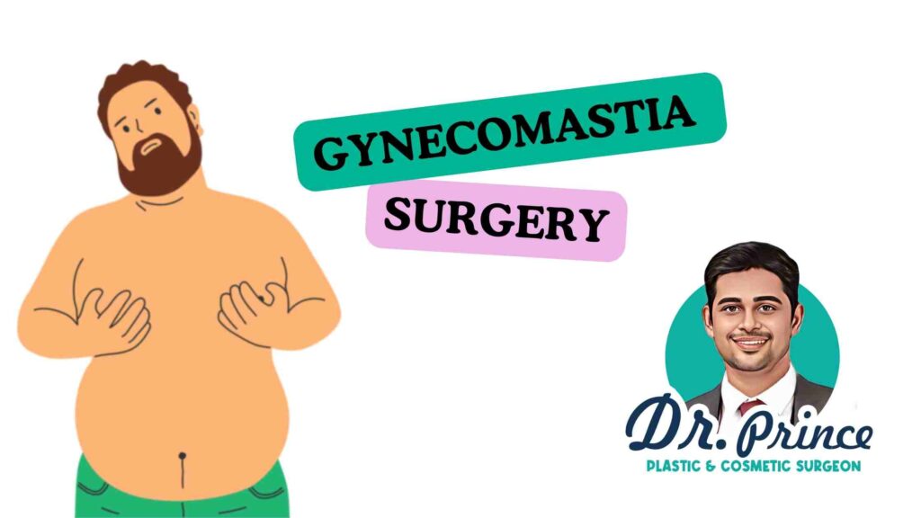 Gynecomastia Surgery In Thrissur By Expert Plastic Surgeon Dr Prince