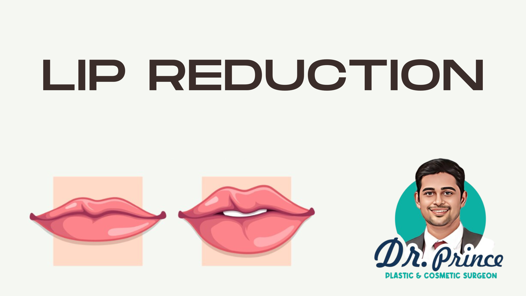 Dr. Prince, the Best Plastic Surgeon in Thrissur, performing lip reduction surgery to achieve natural and balanced facial harmony. The image showcases the expertise and personalized care at Sushrutha Institute of Plastic Surgery, Elite Hospital, Thrissur.