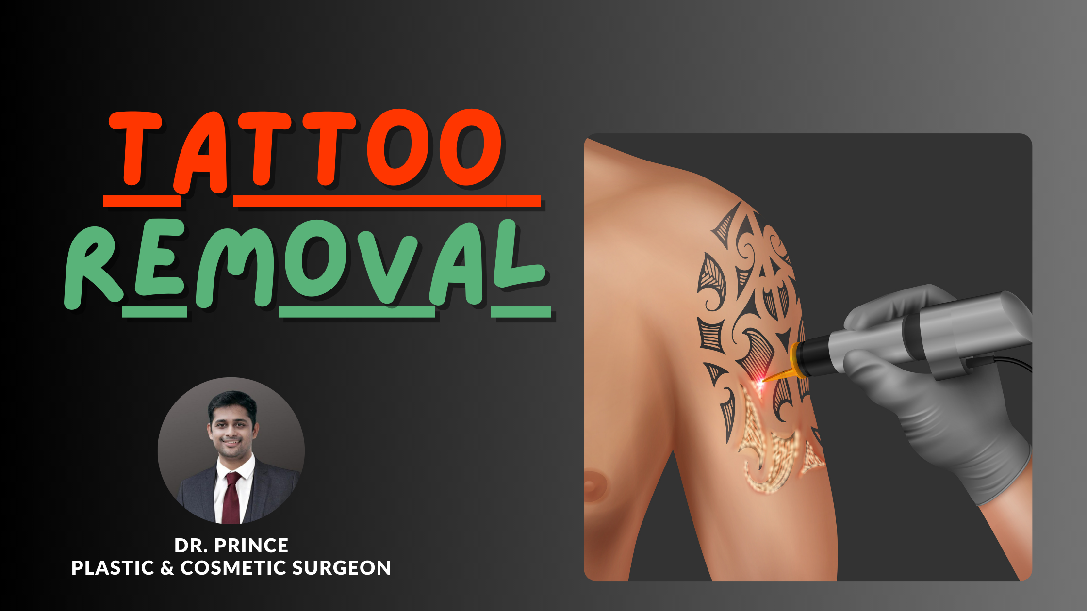 Dr. Prince performs tattoo removal, skillfully erasing ink and restoring the skin's natural canvas with precision.