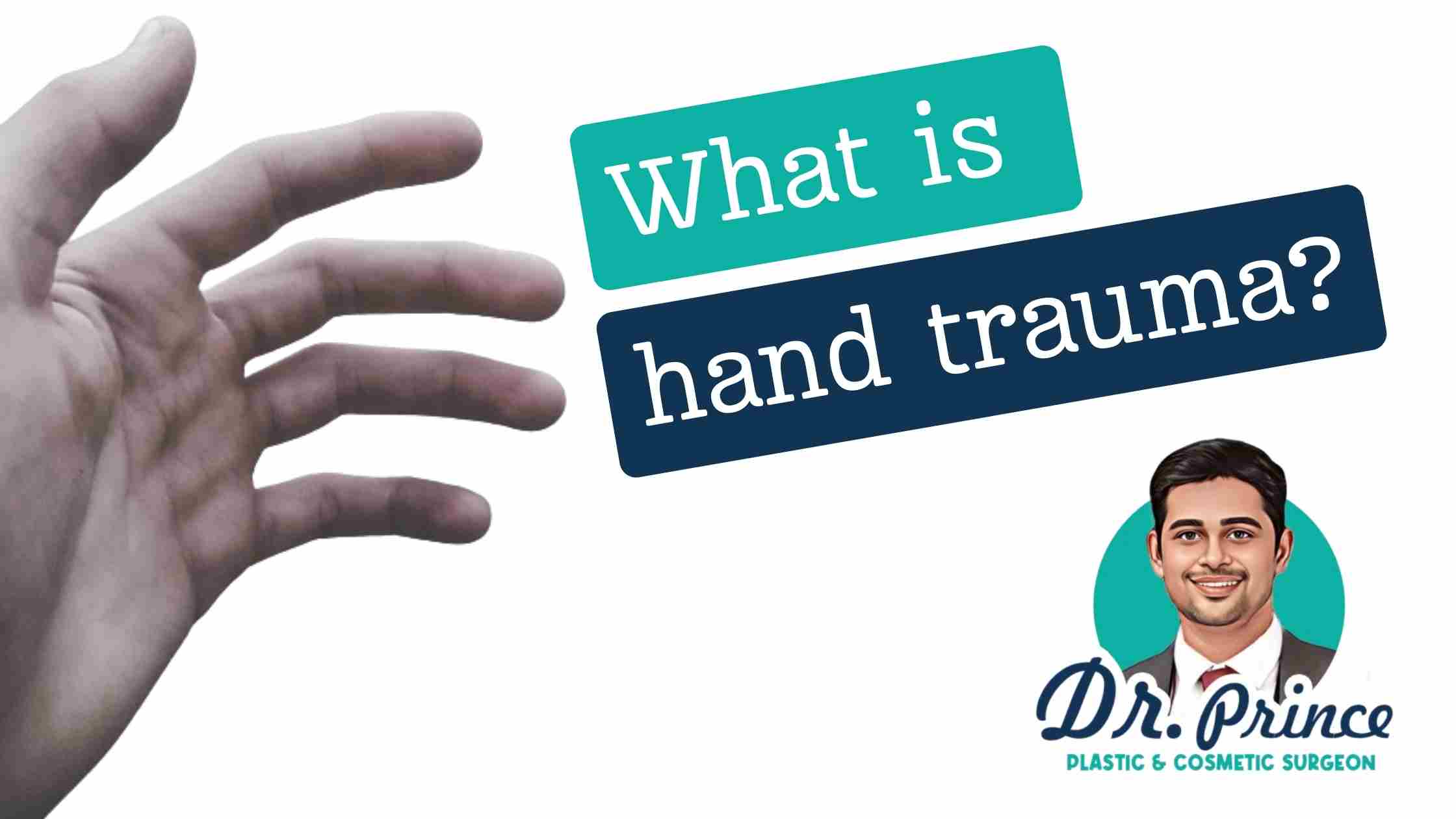 Illustration depicting the concept of hand trauma