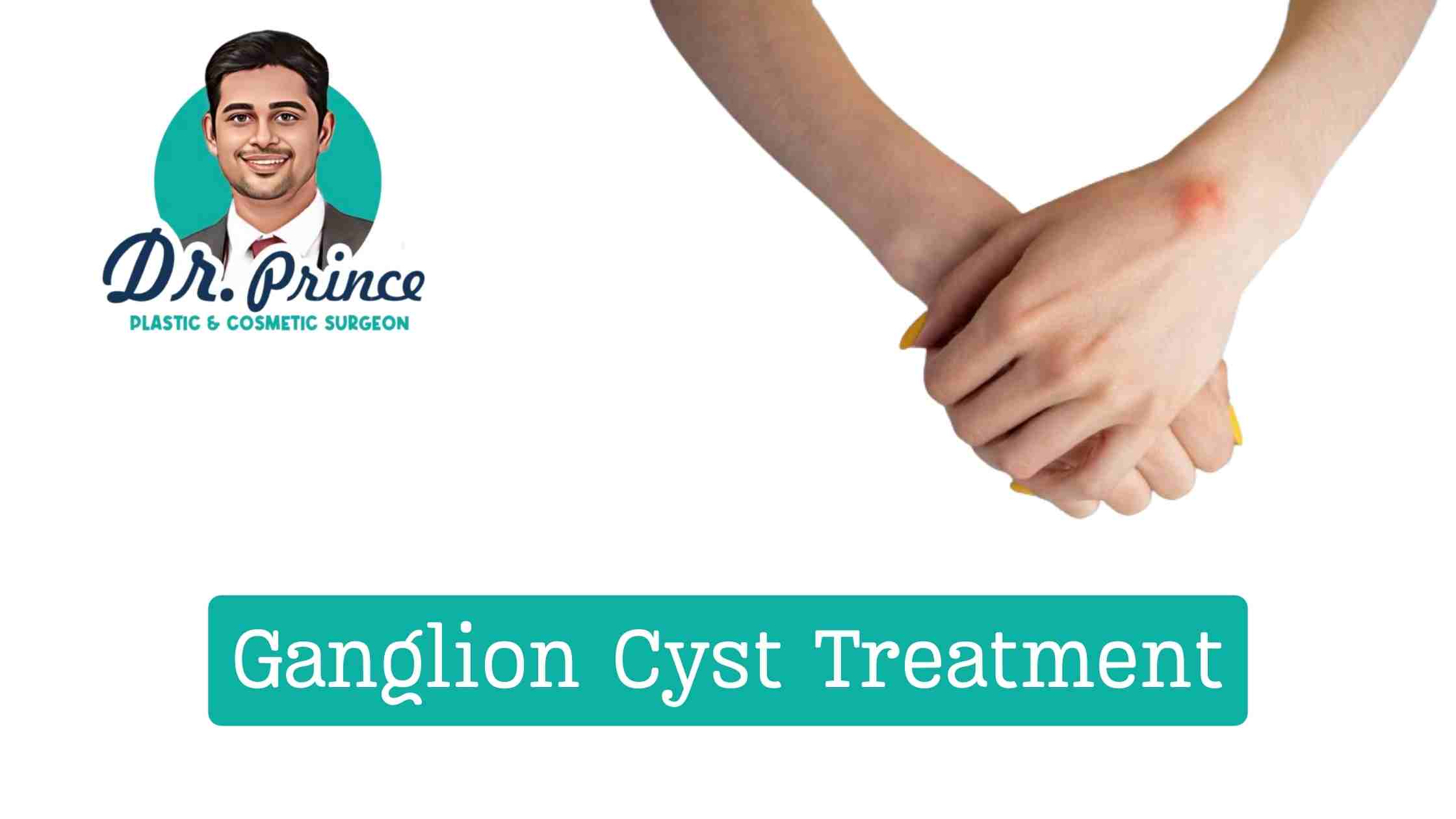 Ganglion Cyst Removal Surgery - Dr. Prince at Sushrutha Institute of Plastic Surgery, Thrissur.