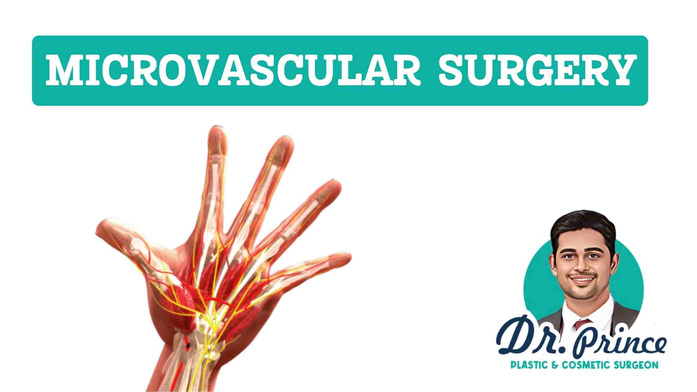 Microvascular Surgery Excellence by Dr. Prince