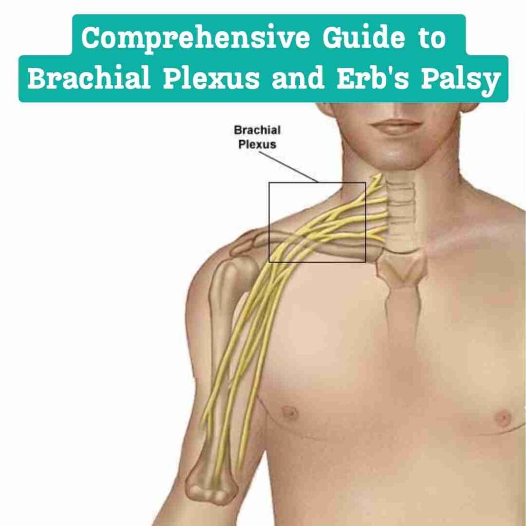 Anatomical illustration showcasing the intricate brachial plexus nerves responsible for arm and hand movement.