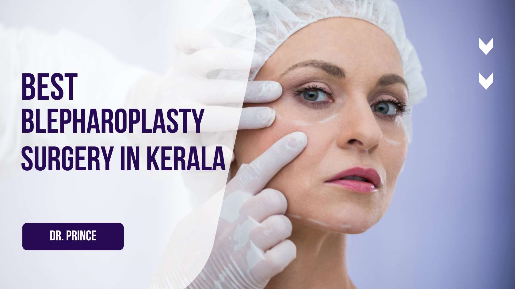 Blepharoplasty Surgery in Kerala - Rejuvenate Your Eyes