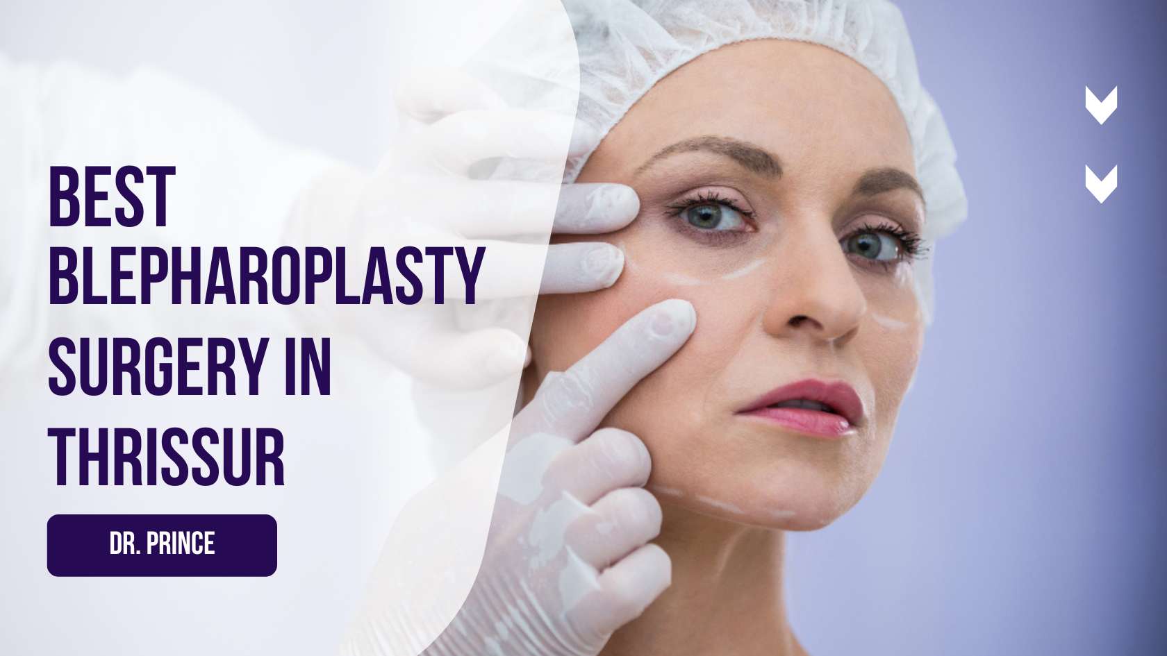 Blepharoplasty Surgery Before and After Results