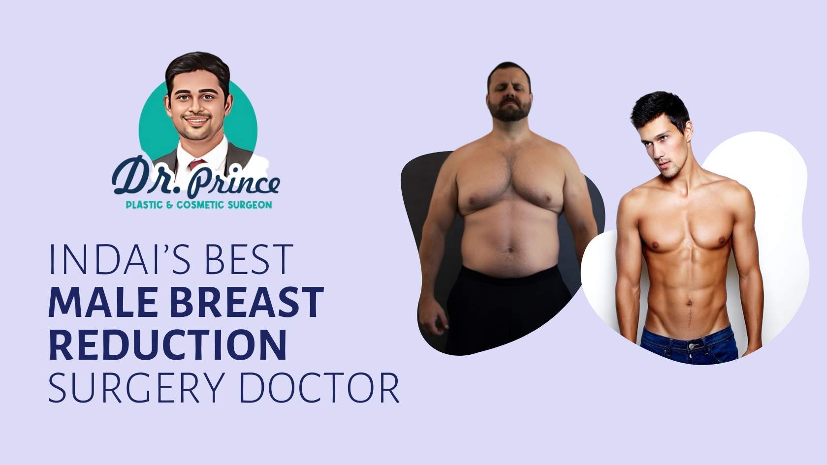 Male Breast Reduction Surgery Concept