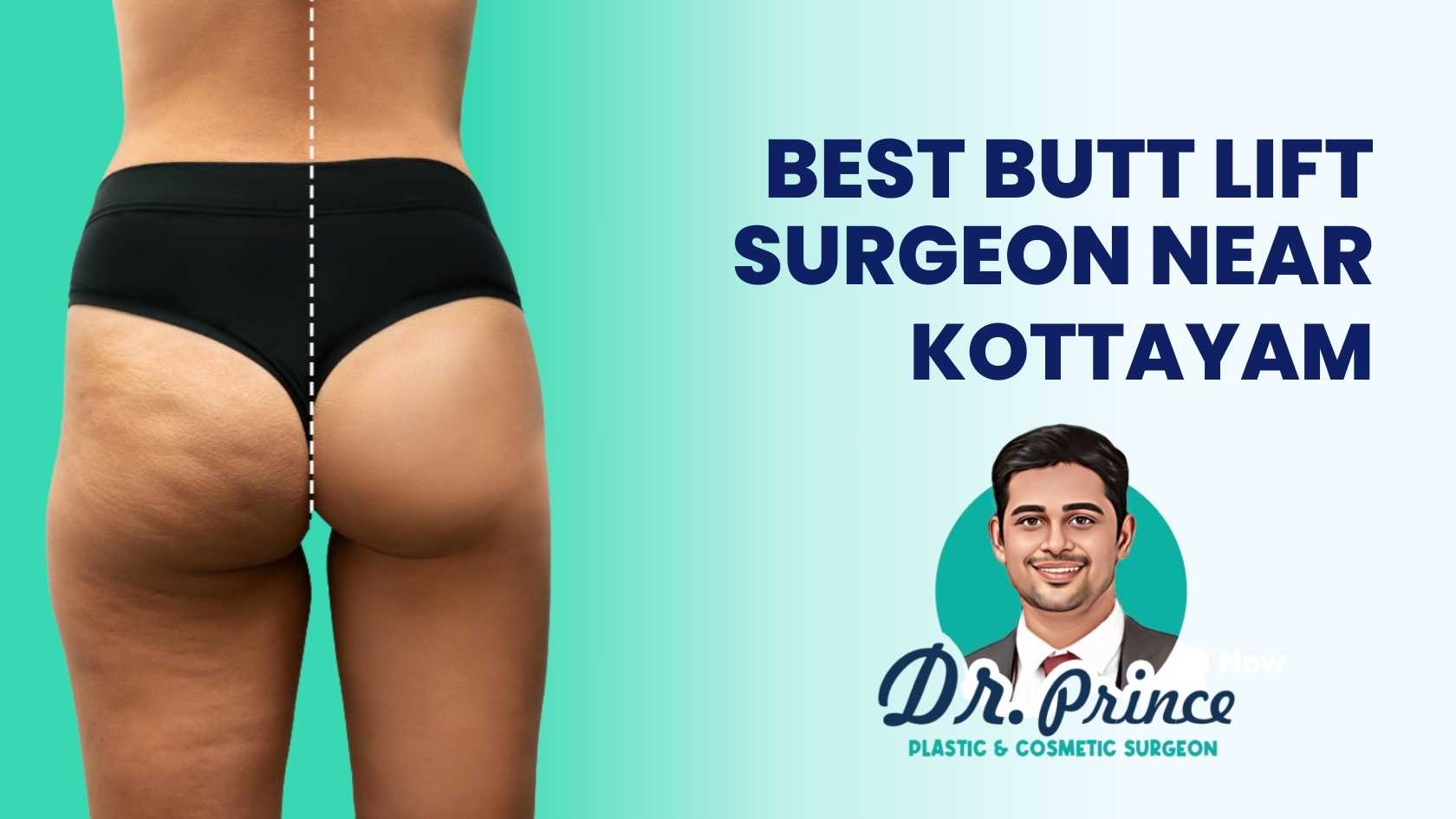 Brazilian butt lift Surgery in Gurgaon