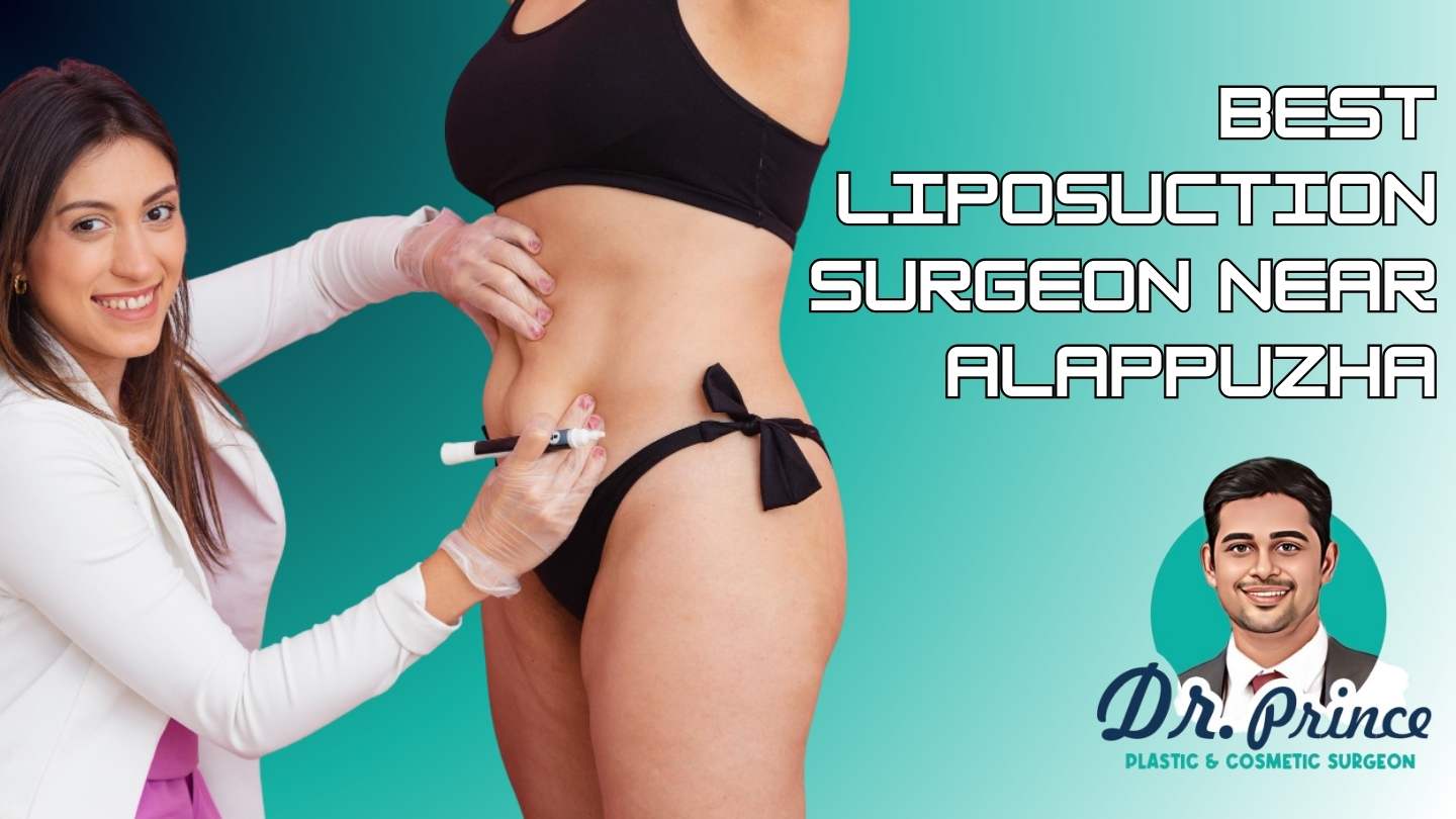 Dr. Prince discussing liposuction surgery options with a patient
