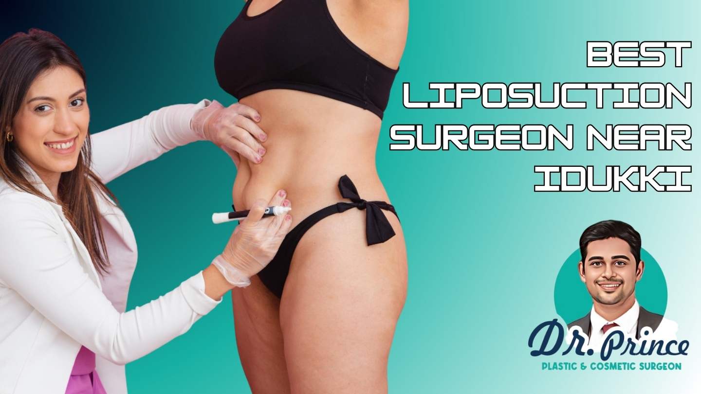 Liposuction Surgery - Dr. Prince