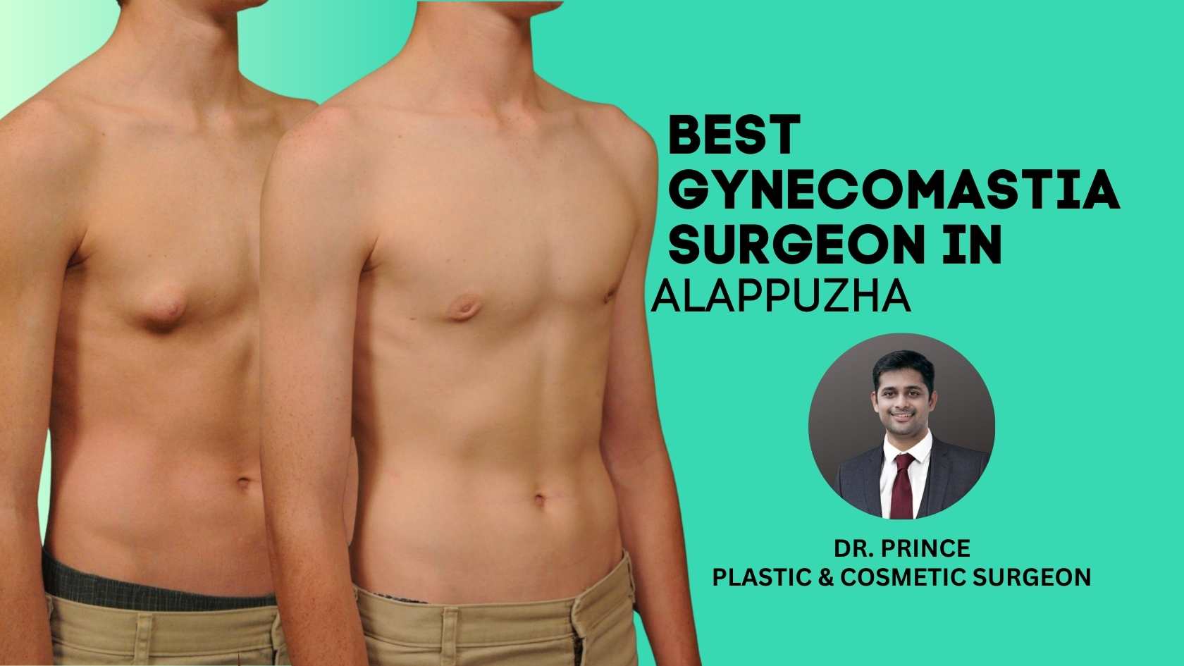 Best Gynecomastia Surgeon in Alappuzha
