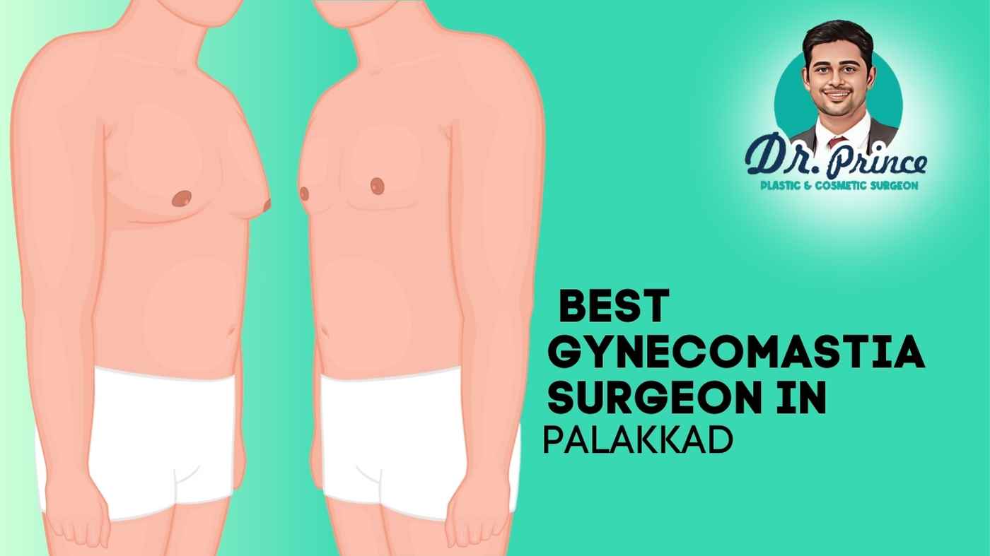 Dr. Prince - Best Gynecomastia Surgeon in Palakkad