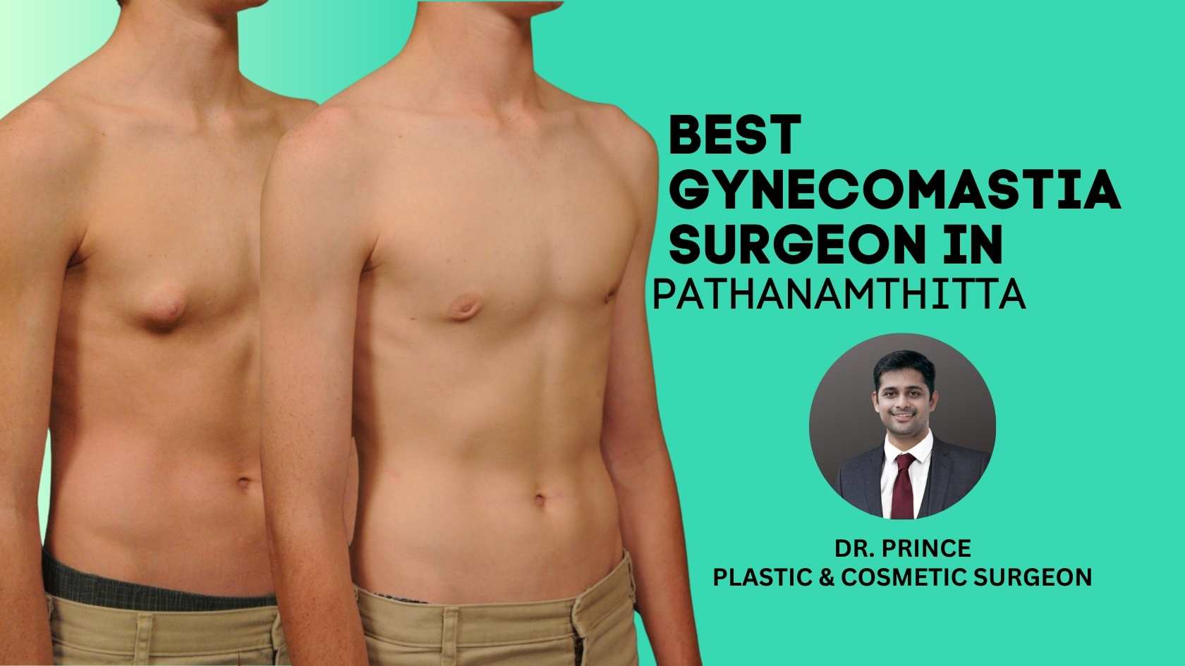 Dr. Prince, Renowned Gynecomastia Surgeon in Pathanamthitta