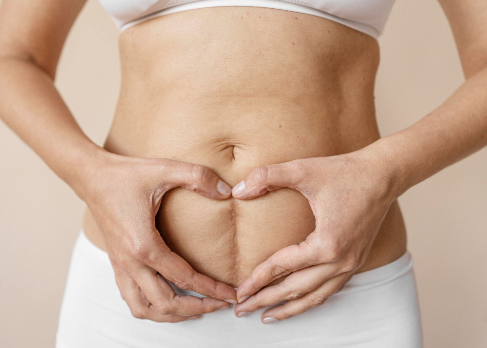 Image showing a person's abdomen before tummy tuck surgery, accompanied by text "Achieve Your Desired Look with Tummy Tuck Surgery near Alappuzha.