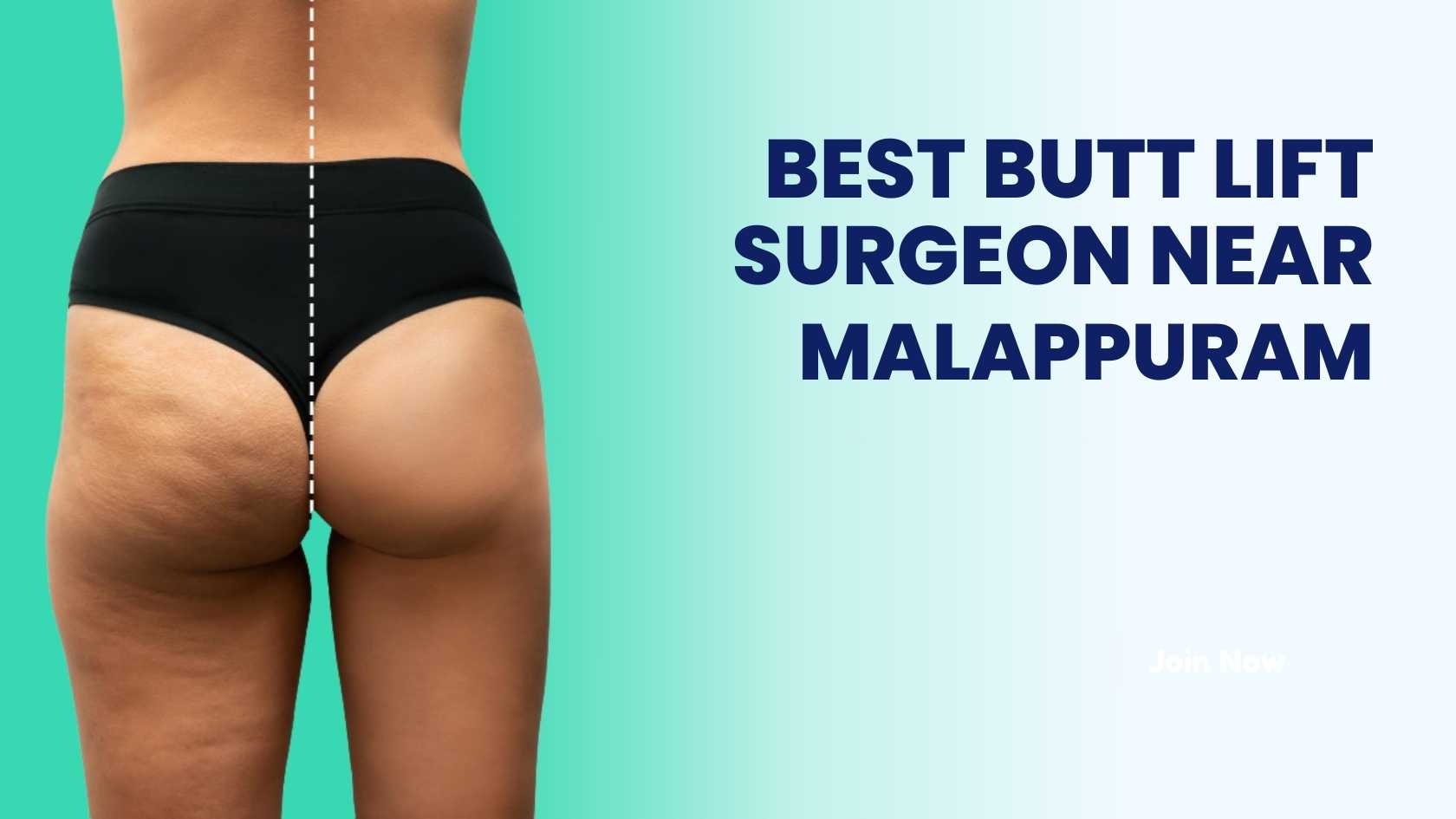 Dr. Prince specializes in butt lift surgeries near Malappuram