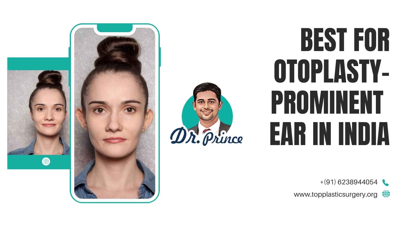 Dr. Prince specializes in otoplasty to correct prominent ears.