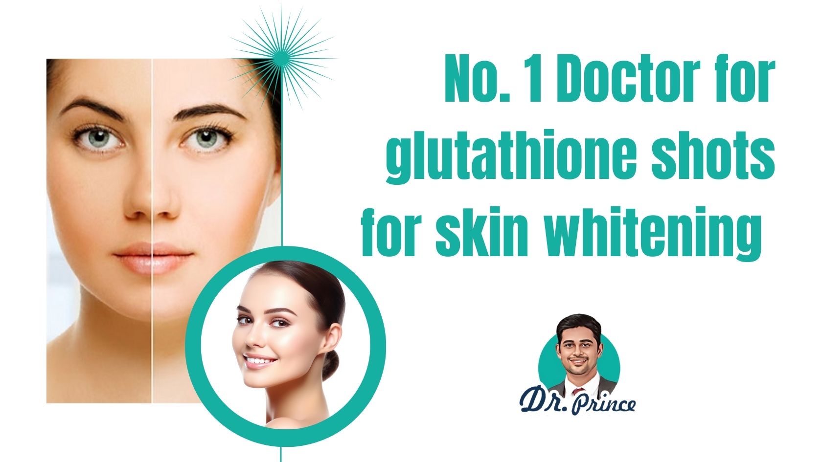 Dr. Prince administering a glutathione shot for skin whitening in Kerala