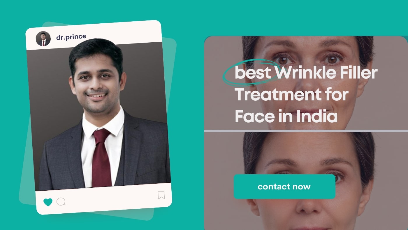Wrinkle Filler Treatment for Face in India - Dr. Prince