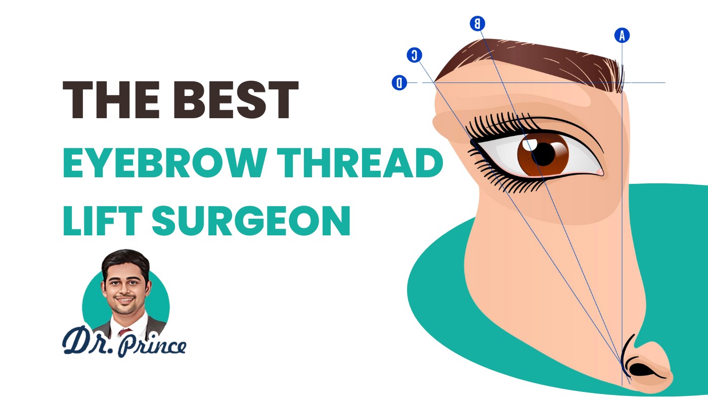 Dr. Prince performing an eyebrow thread lift procedure at Elite Hospital in Thrissur, Kerala