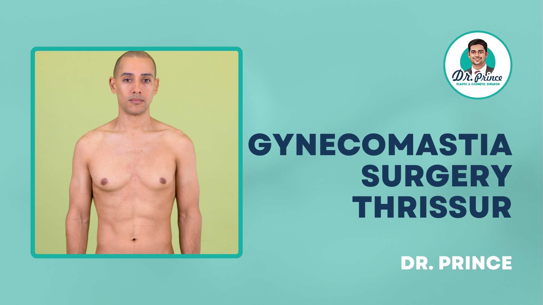 Gynecomastia Surgery in Thrissur by Dr. Prince - Male Breast Reduction