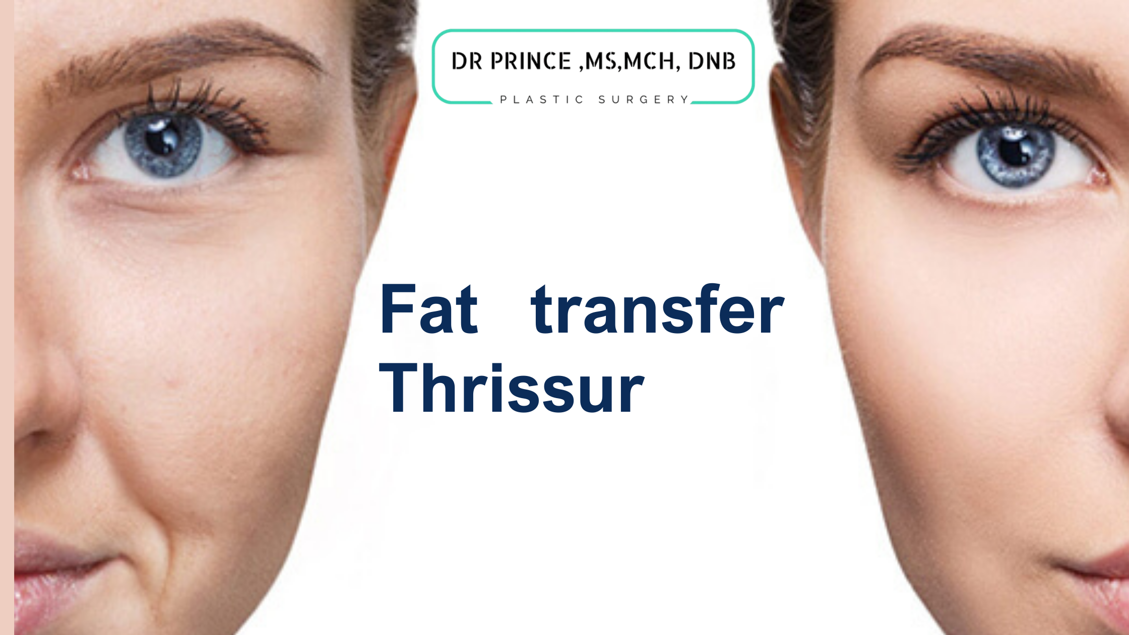 A woman undergoing fat transfer procedure in Thrissur for enhanced body contours.