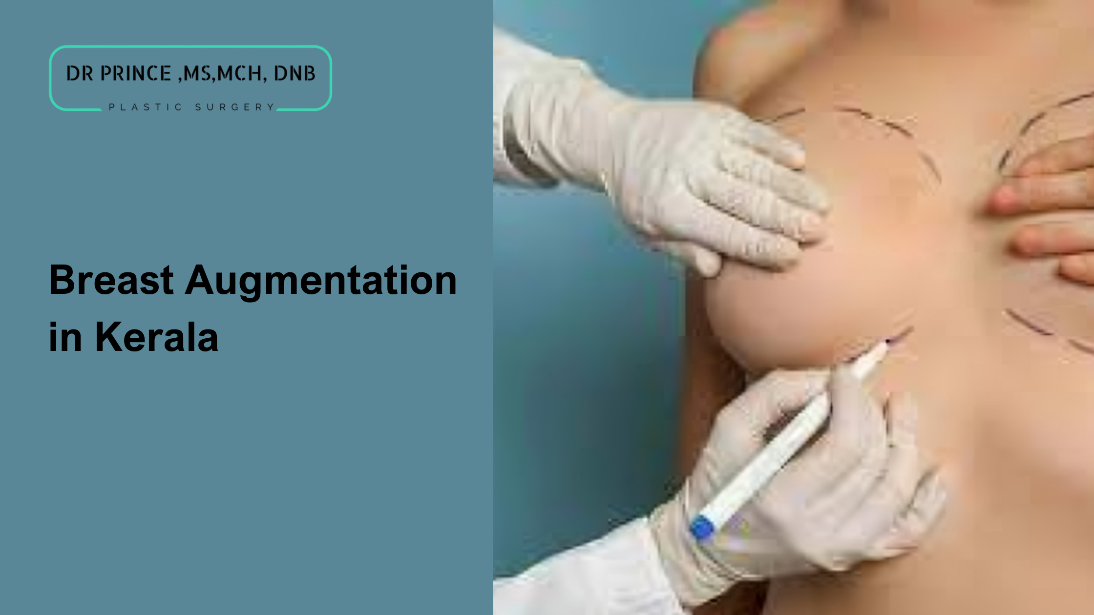 Breast augmentation consultation in Kerala