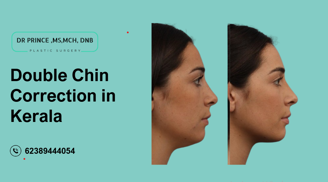 Before and after image showcasing the results of Double Chin Correction in Kerala