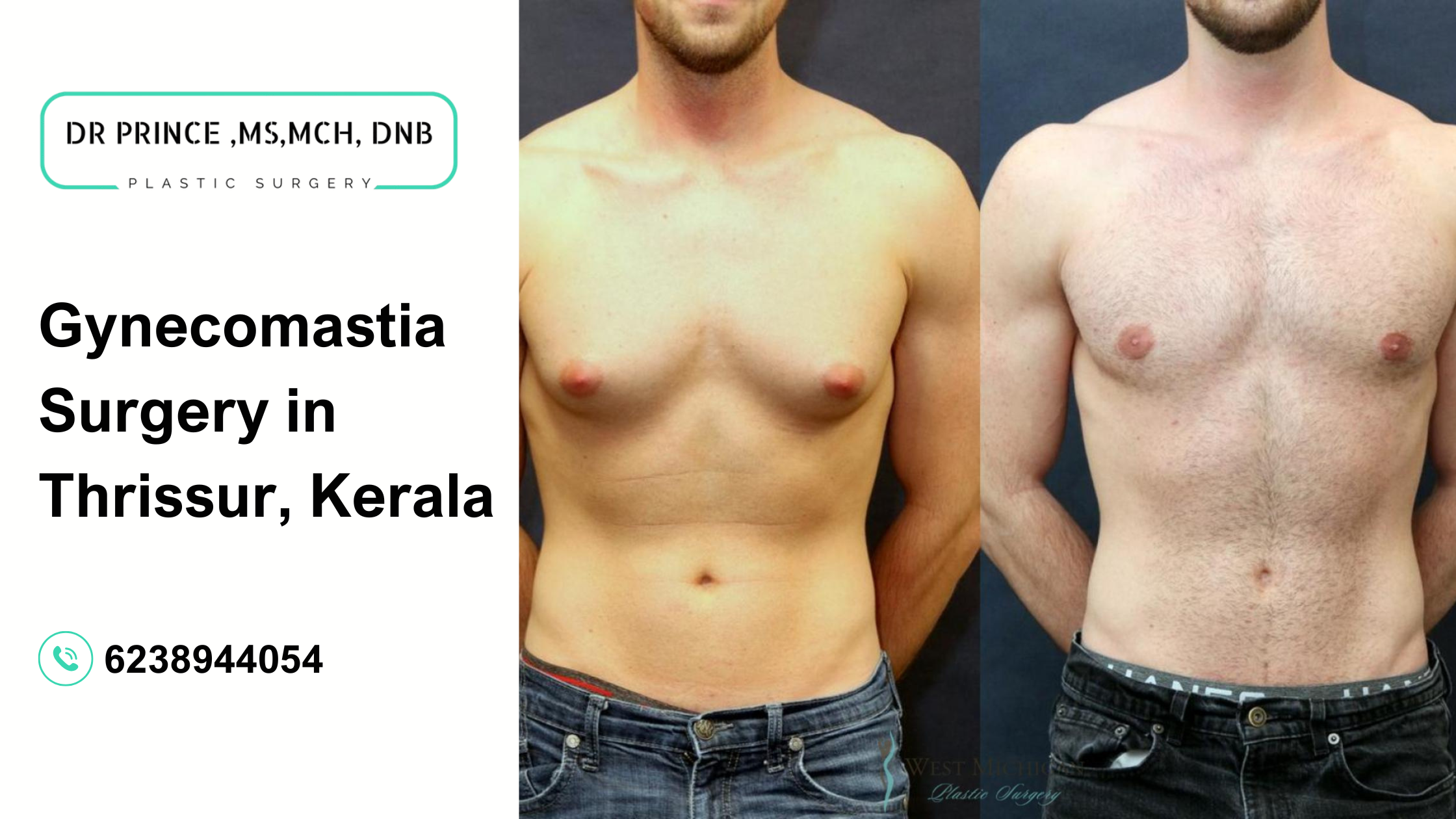 Dr. Prince performing gynecomastia surgery in Thrissur, Kerala.