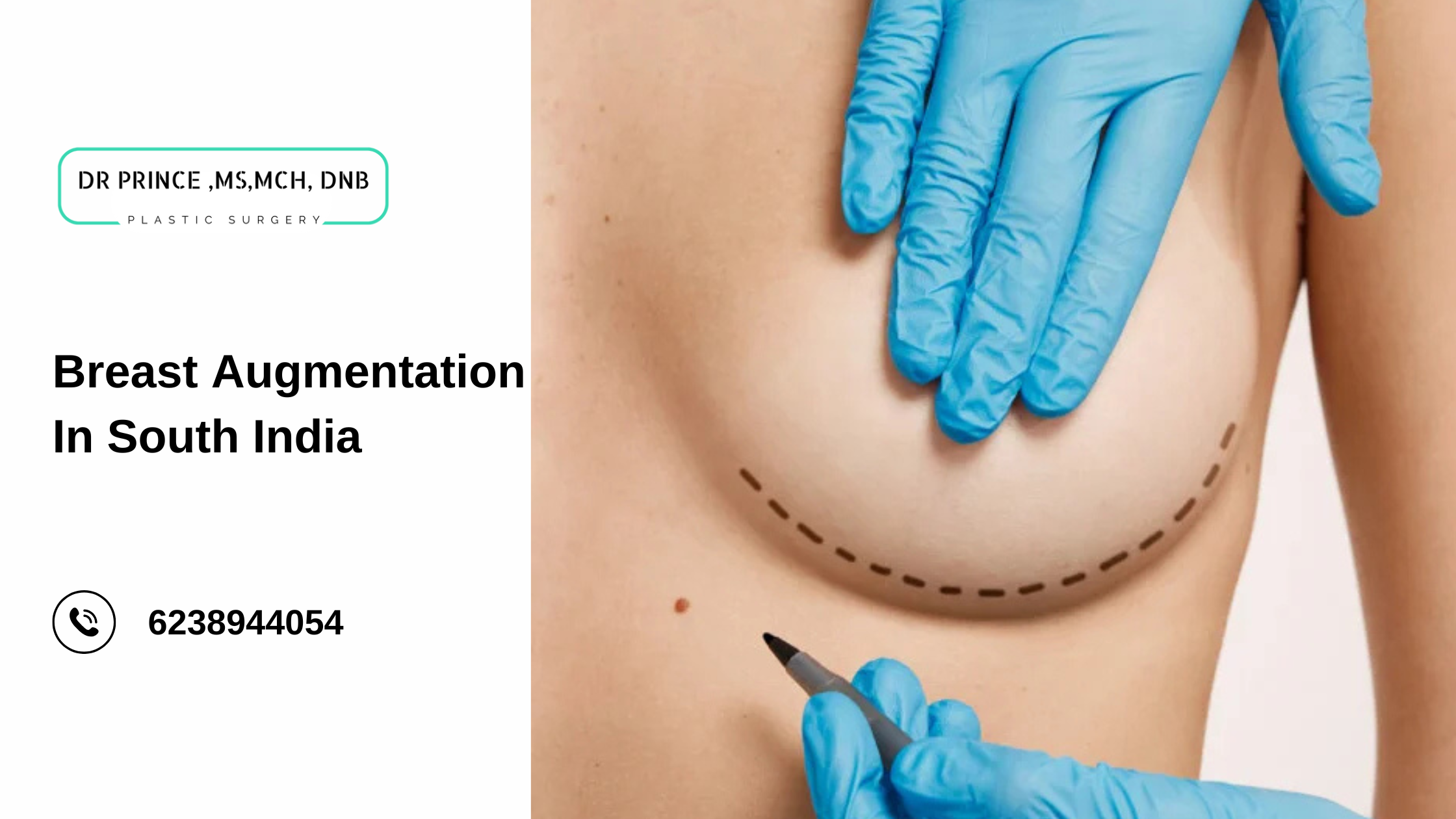 Breast augmentation in South India - Safe and expert procedures by Dr. Prince.