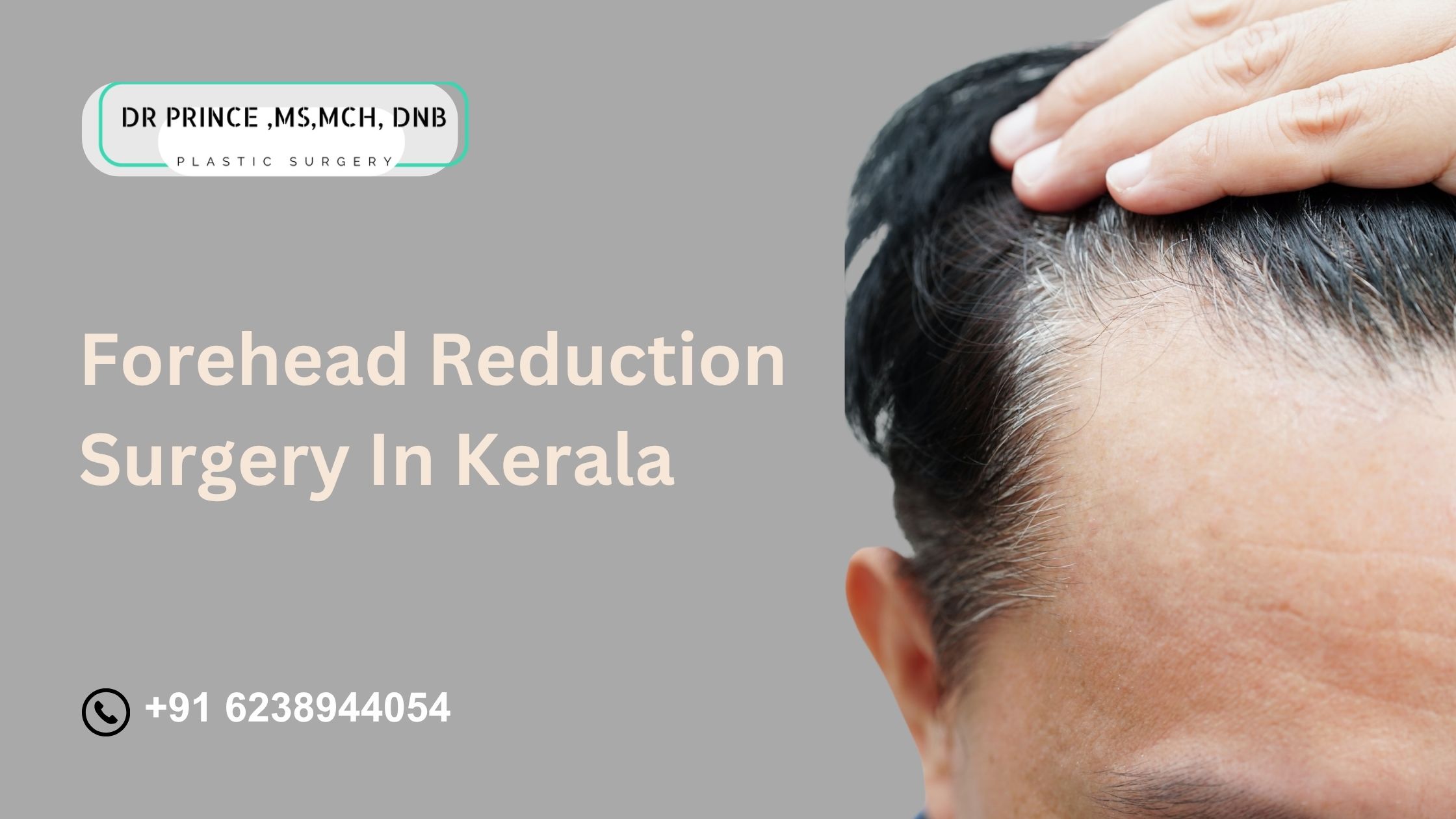 Forehead Reduction Surgery in Kerala – Before and After Results