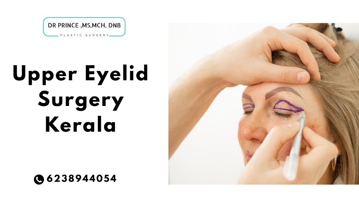 Patient transformation after upper eyelid surgery Kerala by Dr. Prince in Thrissur