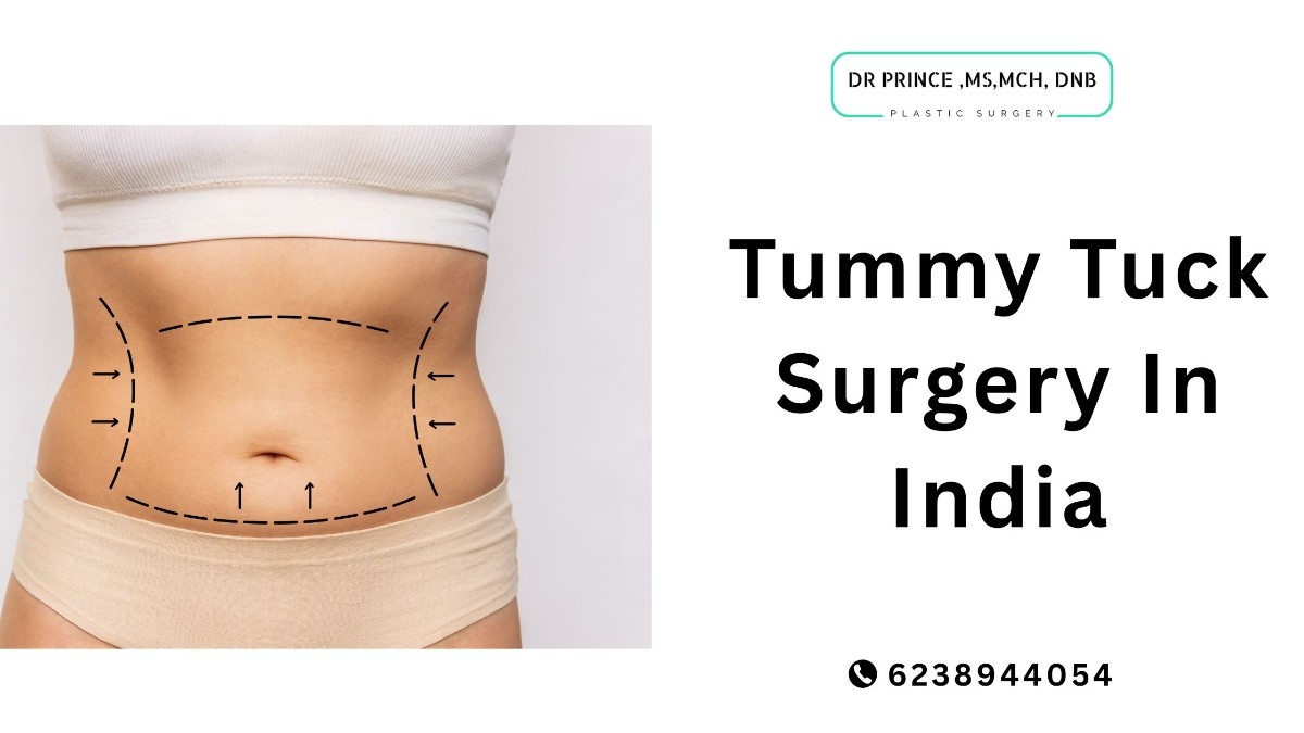 Tummy Tuck Surgery in India by Dr. Prince