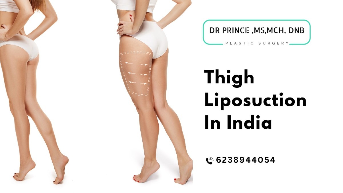 Dr. Prince performing Thigh Liposuction in India at his clinic in Thrissur