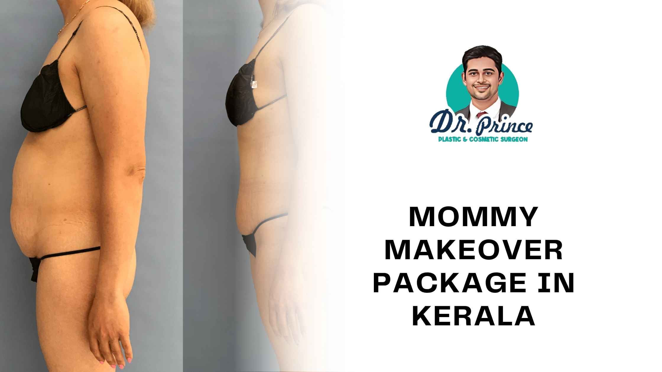 Transform your body with Dr. Prince’s expert mommy makeover package in Kerala