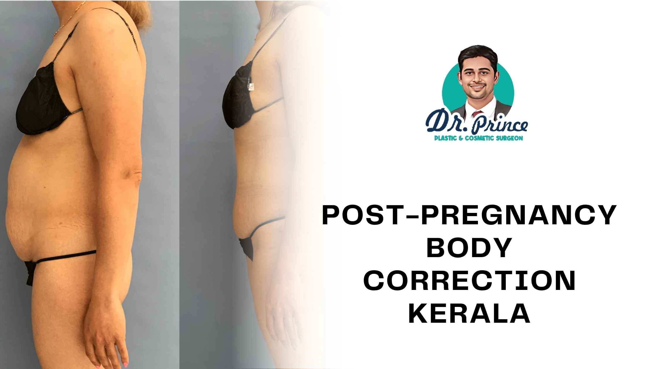 Woman smiling confidently after post-pregnancy body correction in Kerala by Dr. Prince