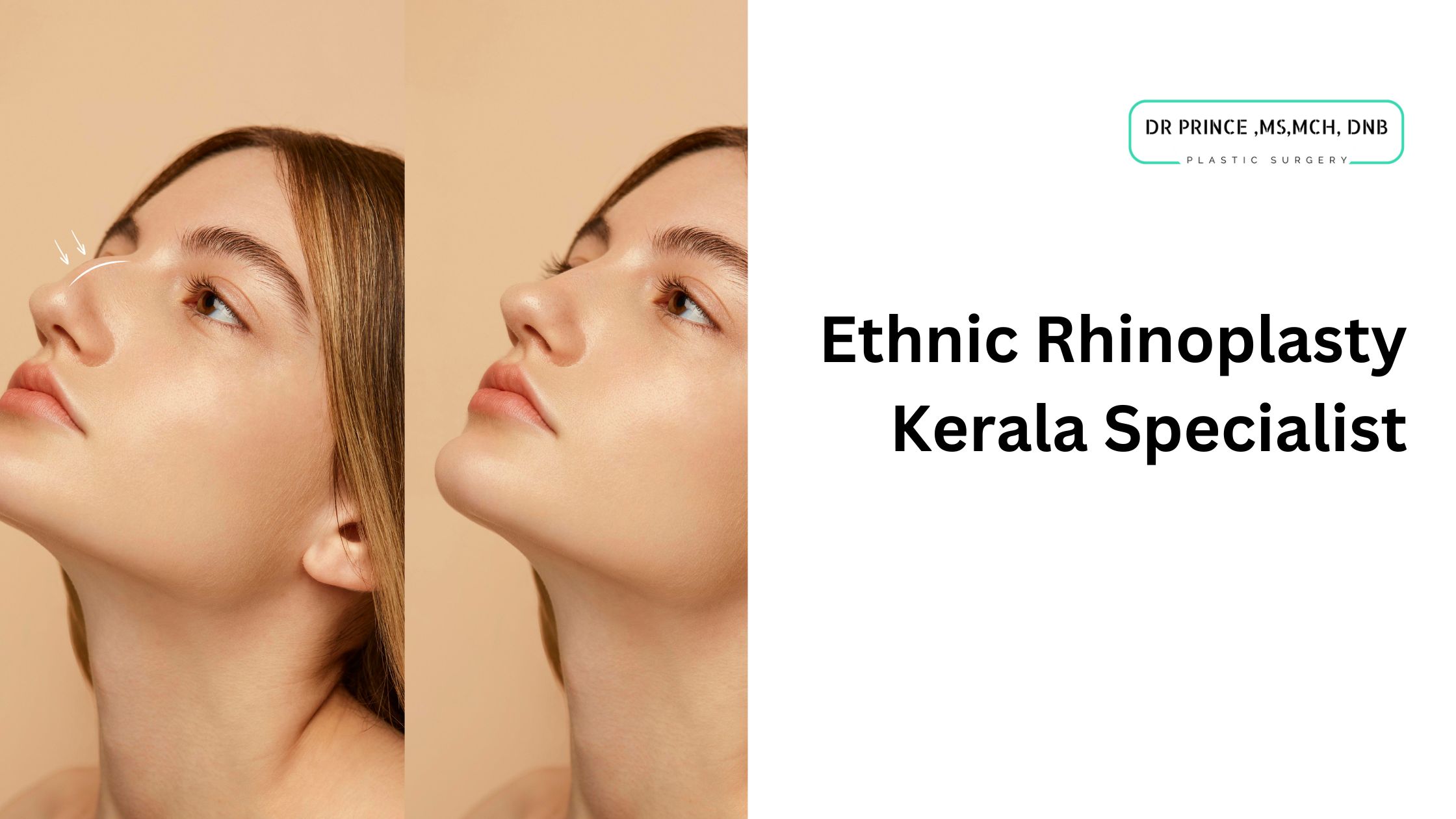 ethnic rhinoplasty Kerala specialist