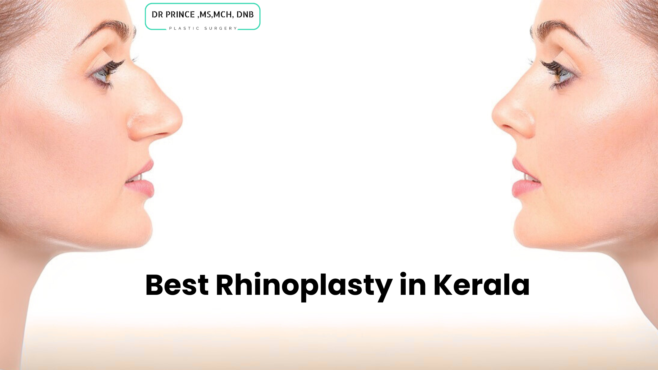 Best Rhinoplasty in Kerala