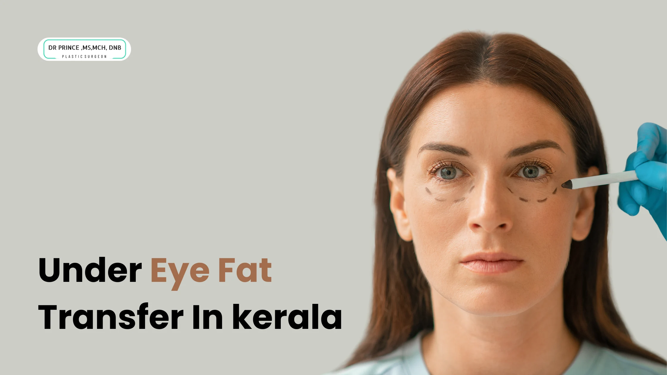 Under Eye Fat Transfer In kerala