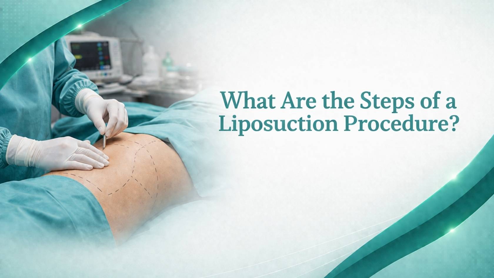 Surgeon marking patient’s body for liposuction procedure steps in a clinical setting