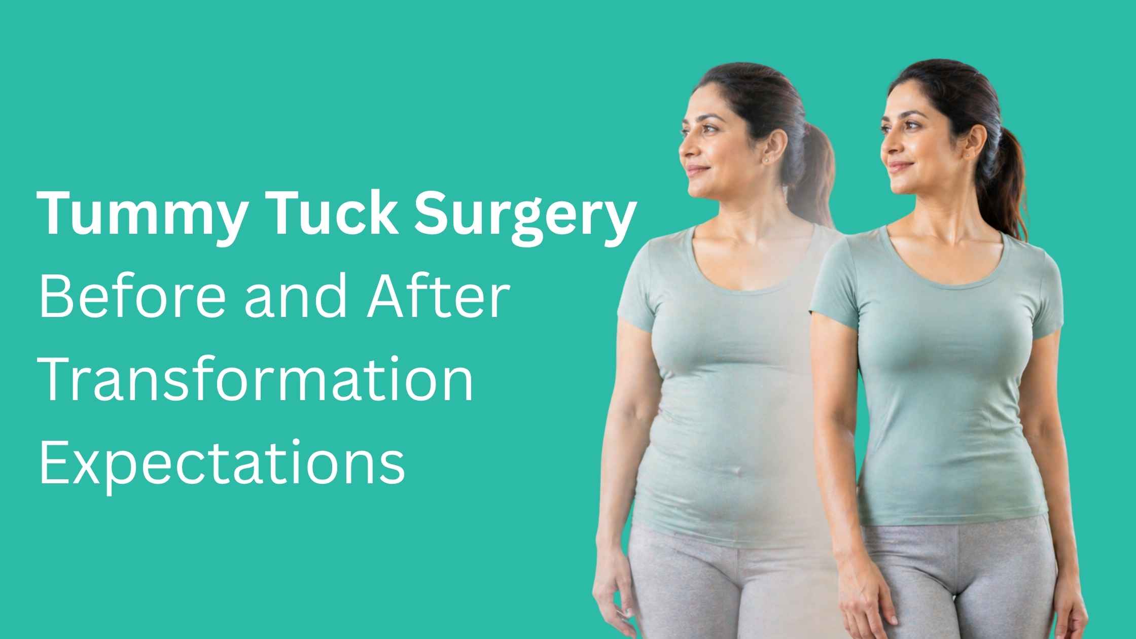 Tummy Tuck Surgery Before and After Transformation Expectations showing visible body contour improvement