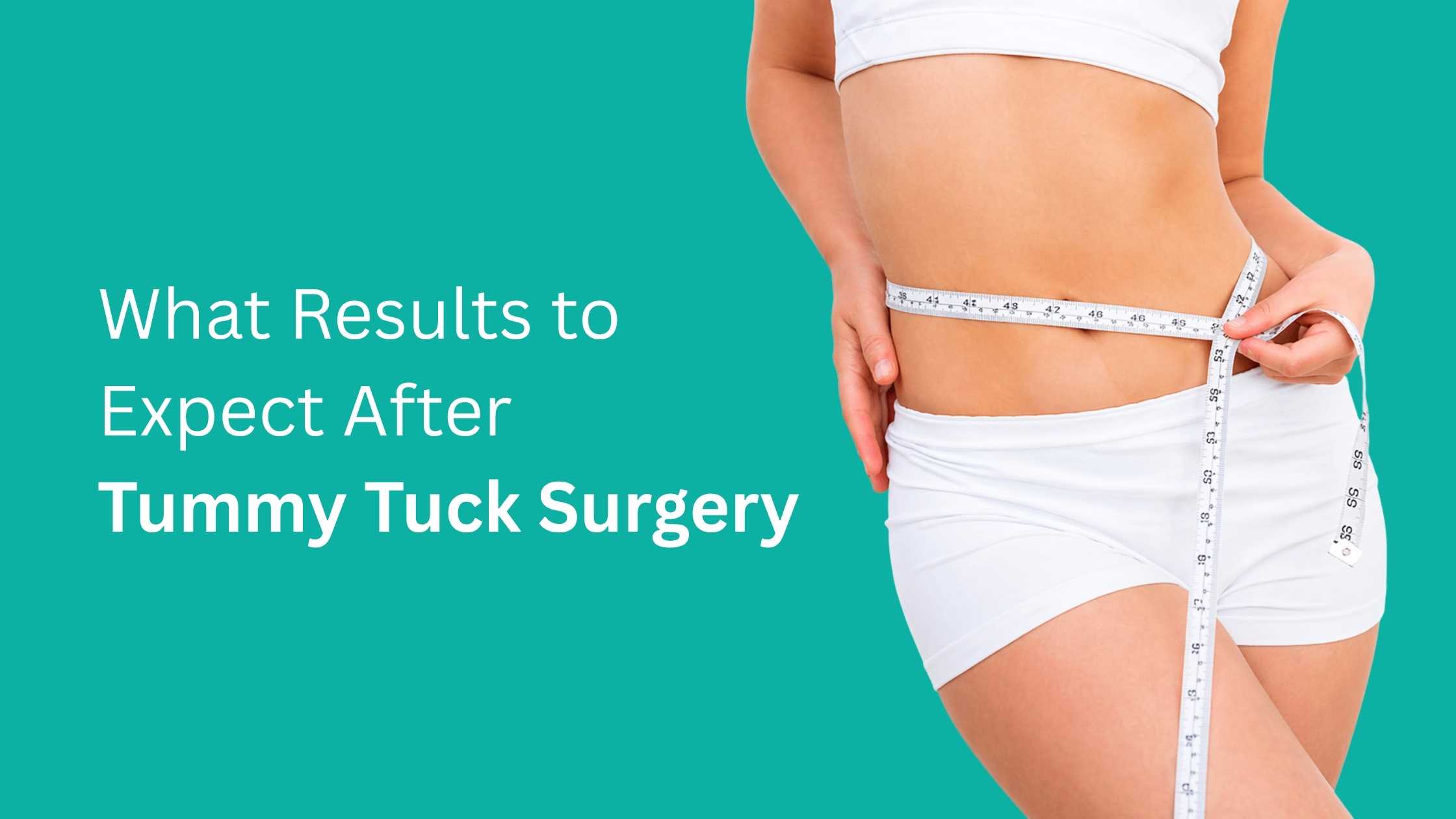 What Results to Expect After Tummy Tuck Surgery showing a toned abdomen and improved body contour