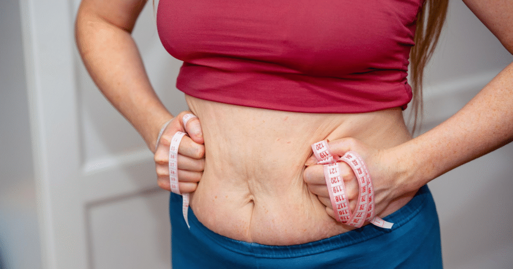 When can you get a mommy makeover after pregnancy and weight stabilization shown through post-pregnancy abdominal changes.