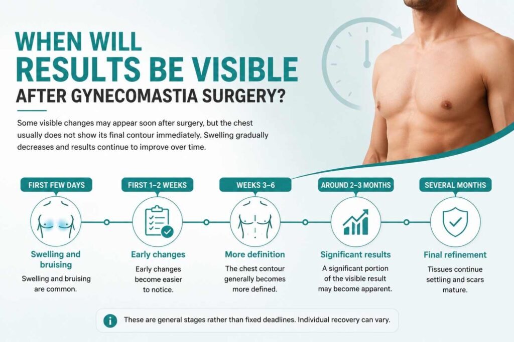 When will results be visible after gynecomastia surgery? Recovery timeline showing swelling, early changes, increased chest definition, visible results, and final tissue settling.