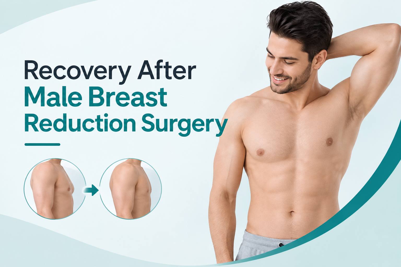 Recovery after male breast reduction surgery showing a flatter chest contour and healing progression