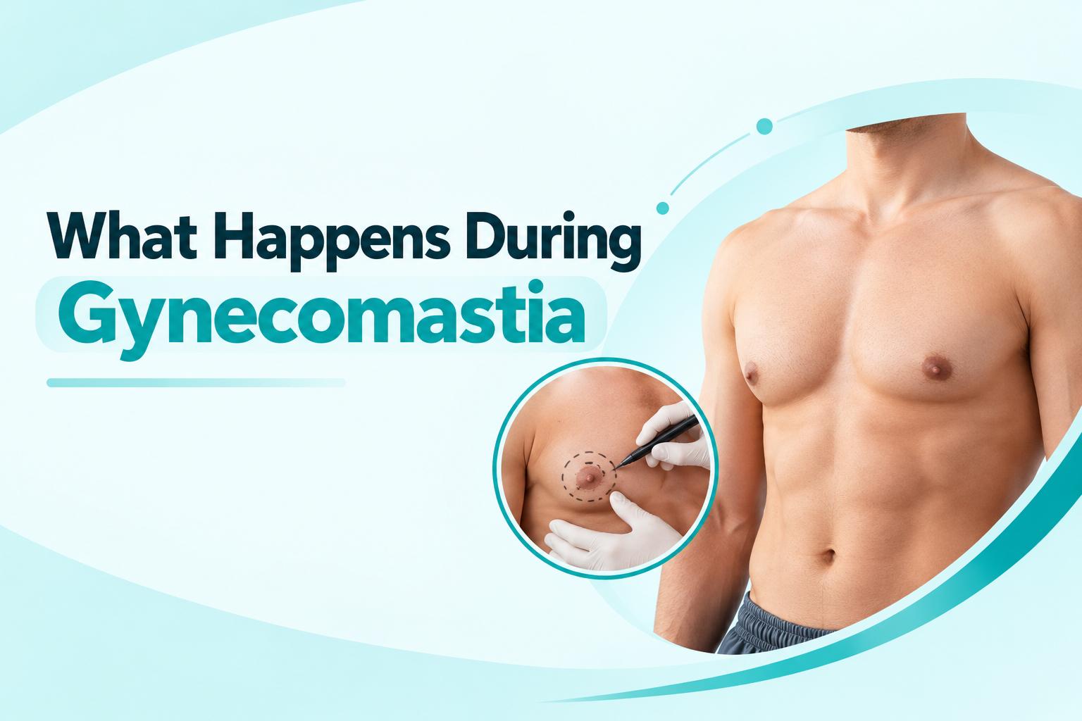 What happens during gynecomastia showing male chest and surgical assessment